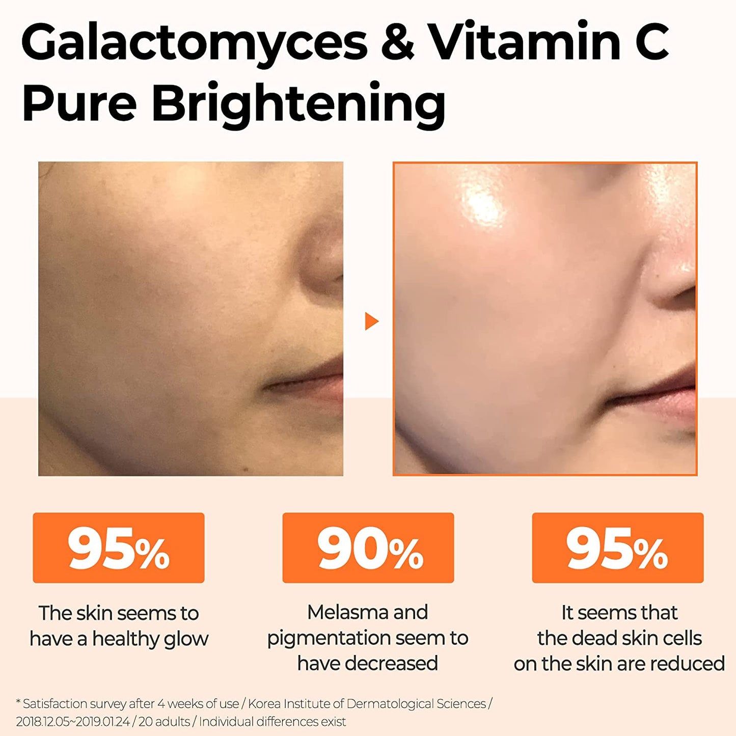 [SOMEBYMI] Galactomyces Pure Vitamin C Glow Serum 30ml