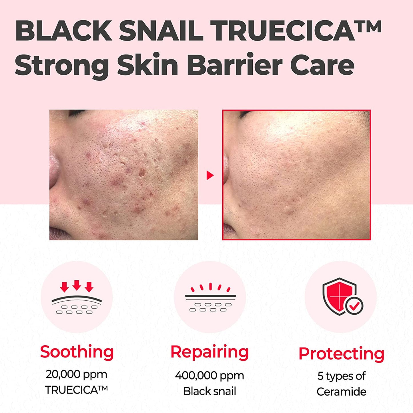 [SOMEBYMI] Snail Truecica Miracle Repair Cream 60ml